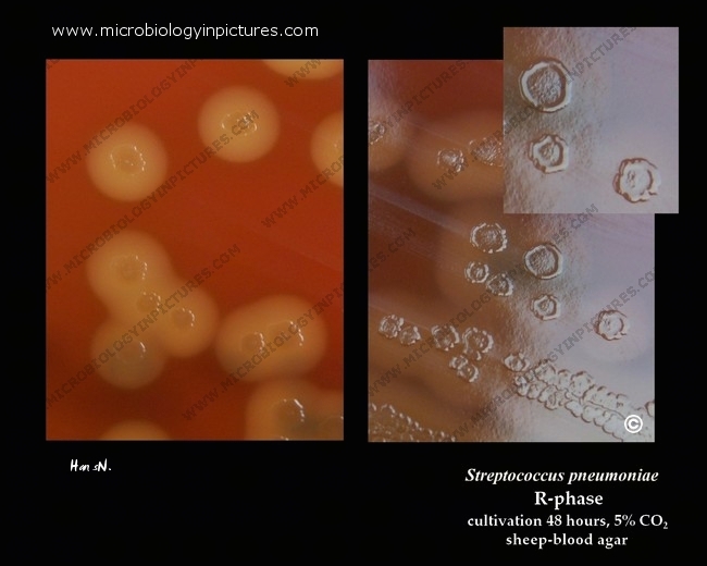 Streptococcus Pneumoniae R Form R Phase Colonies In Detail Alpha Hemolysis Of Streptococcus